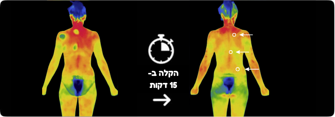 אלוטבע (32).png__PID:4107045b-6ad3-451b-ae7d-cf45401fab53
