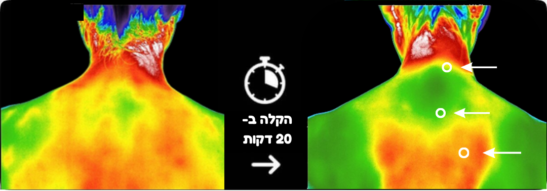 אלוטבע (33).png__PID:045b6ad3-b51b-4e7d-8f45-401fab53c74c
