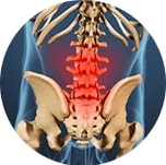osteoarthritis_6315fa16-57e9-4615-b6a1-19c10f61995d__PID:ff6dcc82-5ab1-41a6-84a0-b46d3c90f6fa