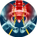 sciatica_f3f476c6-8c5d-40b2-b985-614af7731921__PID:0f5bf63b-ff6d-4c82-9ab1-41a6c4a0b46d